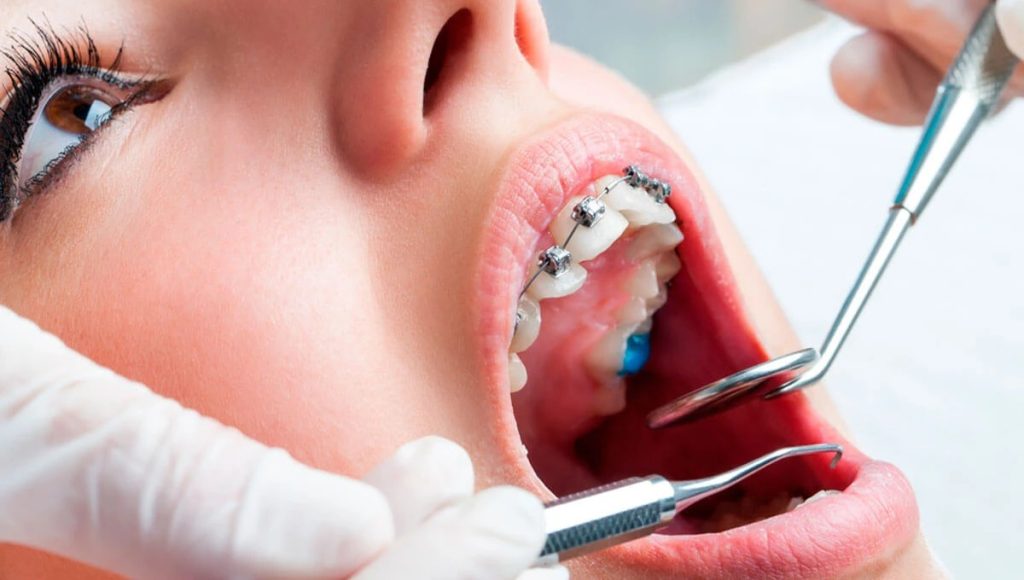 Invista em um sorriso saudável e bonito: a importância do tratamento ortodôntico